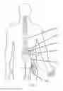 Fig. 02 - Systems and methods for spasticity treatment using spinal nerve magnetic stimulation