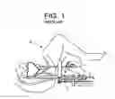 Fig. 02 - BRACHYTHERAPY TEMPLATE ADAPTOR