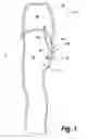 Fig. 02 - High-pressure passthrough for protective suit
