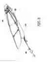 Fig. 06 - Folding Kite and Launcher System