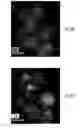 Fig. 38 - Compositions, systems and methods for producing nanoalloys and/or nanocomposites using tandem laser ablation synthesis in solution-galvanic replacement reaction