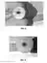 Fig. 09 - Vented sand core for sand casting