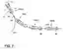 Fig. 07 - Trailer backup assist remote knob state management