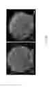Fig. 45 - Bicyclic compound and pharmaceutical composition thereof for treating stroke and use thereof