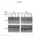 Fig. 44 - Compositions and methods for the treatment of hemoglobinopathies