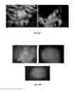 Fig. 10 - Methods for Culturing Cells in an Alternating Ionic Magnetic Resonance (AIMR) Multiple-Chambered Culture Apparatus