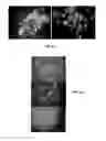 Fig. 11 - Methods for Culturing Cells in an Alternating Ionic Magnetic Resonance (AIMR) Multiple-Chambered Culture Apparatus