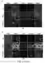 Fig. 09 - COMPOSITIONS AND METHODS FOR TREATING HEPATIC FIBROSIS