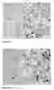 Fig. 08 - Analysis of T-cell monotypia