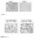 Fig. 09 - Analysis of T-cell monotypia