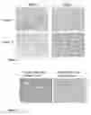 Fig. 10 - Analysis of T-cell monotypia