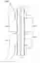 Fig. 04 - SCREW BOLT, CASING FOR A TURBINE, TURBINE AND METHOD FOR ASSEMBLING A CASING OF A TURBINE