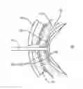 Fig. 01 - METHODS AND SYSTEMS FOR TREATING MEIBOMIAN GLAND DYSFUNCTION USING RADIO-FREQUENCY ENERGY