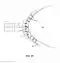 Fig. 08 - METHODS AND SYSTEMS FOR TREATING MEIBOMIAN GLAND DYSFUNCTION USING RADIO-FREQUENCY ENERGY