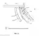 Fig. 19 - METHODS AND SYSTEMS FOR TREATING MEIBOMIAN GLAND DYSFUNCTION USING RADIO-FREQUENCY ENERGY