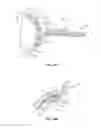 Fig. 27 - METHODS AND SYSTEMS FOR TREATING MEIBOMIAN GLAND DYSFUNCTION USING RADIO-FREQUENCY ENERGY
