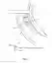 Fig. 29 - METHODS AND SYSTEMS FOR TREATING MEIBOMIAN GLAND DYSFUNCTION USING RADIO-FREQUENCY ENERGY