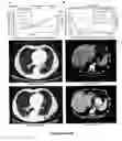 Fig. 08 - Method of assessing disease condition of cancer