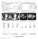 Fig. 19 - Method of assessing disease condition of cancer
