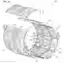 Fig. 02 - Method and apparatus for multi-part body coil