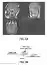 Fig. 06 - Imaging system for single voxel spectroscopy