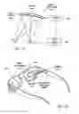 Fig. 62 - Near-to-eye display device