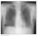 Fig. 01 - System and method for image registration in medical imaging system