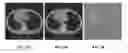 Fig. 09 - System and method for image registration in medical imaging system