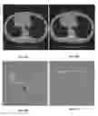 Fig. 11 - System and method for image registration in medical imaging system