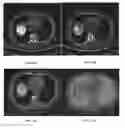 Fig. 13 - System and method for image registration in medical imaging system