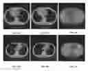 Fig. 15 - System and method for image registration in medical imaging system