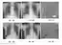 Fig. 16 - System and method for image registration in medical imaging system