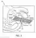 Fig. 04 - System for real-time organ segmentation and tool navigation during tool insertion in interventional therapy and method of operation thereof