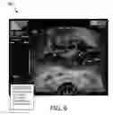 Fig. 07 - System for real-time organ segmentation and tool navigation during tool insertion in interventional therapy and method of operation thereof