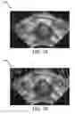 Fig. 08 - System for real-time organ segmentation and tool navigation during tool insertion in interventional therapy and method of operation thereof