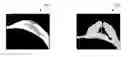 Fig. 01 - Image processing apparatus, image processing method, and program