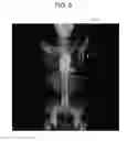 Fig. 09 - MEDICAL IMAGE PROCESSING APPARATUS, MEDICAL IMAGE PROCESSING METHOD, AND MEDICAL IMAGE PROCESSING SYSTEM