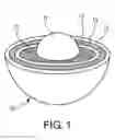 Fig. 02 - Nuclear fuel particle having a pressure vessel comprising layers of pyrolytic graphite and silicon carbide