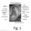 Fig. 02 - Human-ear-wearable apparatus, system, and method of operation