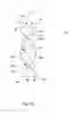 Fig. 06 - SYSTEM AND METHOD FOR RADIATION TREATMENT WITH SPINNER