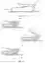 Fig. 30 - Closure devices including incremental release mechanisms and methods therefor