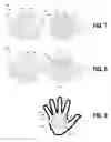 Fig. 06 - Adjustable brush treatment device