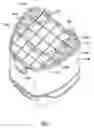 Fig. 08 - Cyclone assembly for surface cleaning apparatus and a surface cleaning apparatus having same