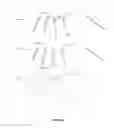 Fig. 16 - Sensor system integrated with a glove