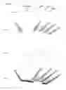 Fig. 19 - Sensor system integrated with a glove