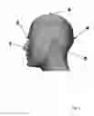Fig. 02 - Cephalostat