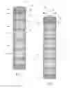 Fig. 02 - Systems and methods for attaching a prosthesis within a body lumen or hollow organ