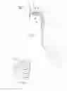 Fig. 06 - Systems and methods for attaching a prosthesis within a body lumen or hollow organ