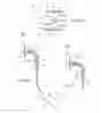Fig. 08 - Systems and methods for attaching a prosthesis within a body lumen or hollow organ