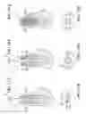 Fig. 09 - Fluted osteotome and surgical method for use